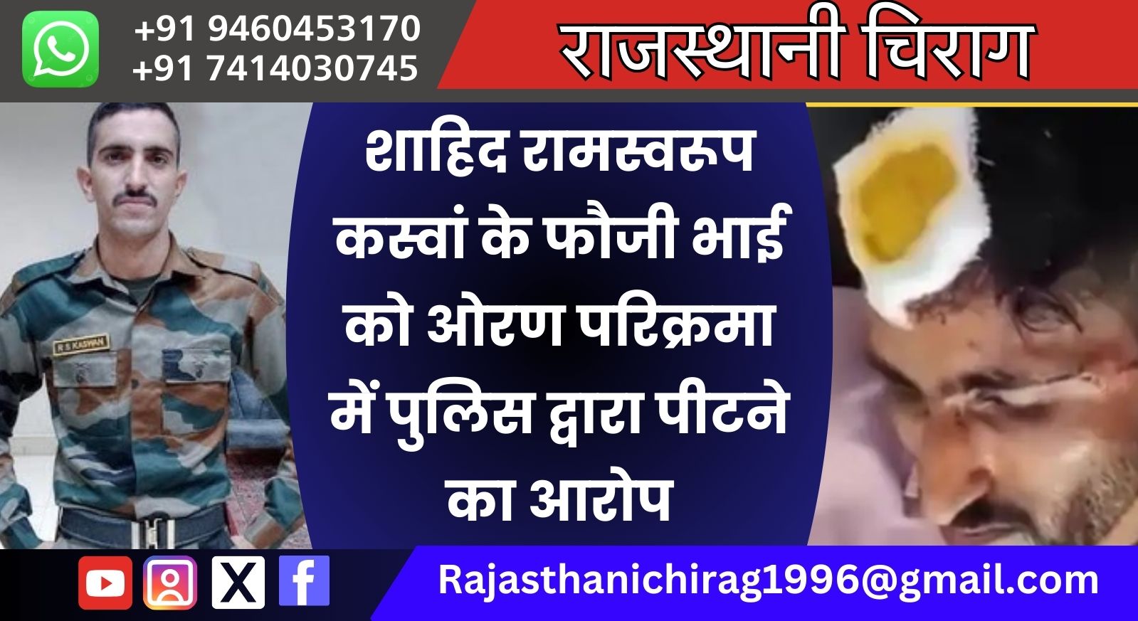 शाहिद रामस्वरूप कस्वां के फौजी भाई को ओरण परिक्रमा में पुलिस द्वारा पीटने का आरोप