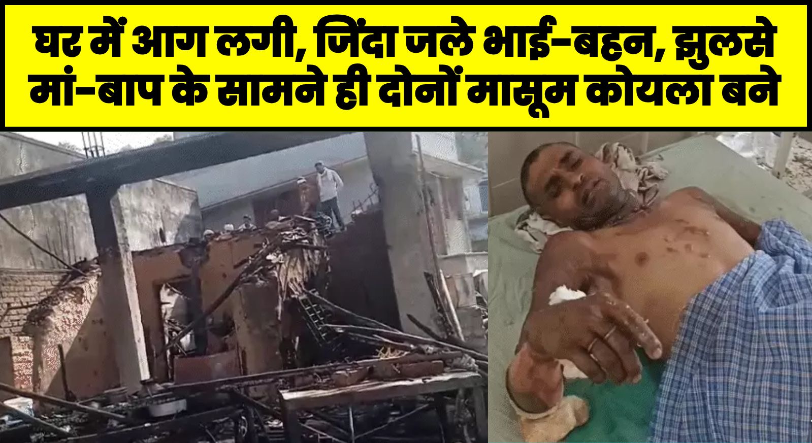 घर में आग लगी, जिंदा जले भाई-बहन, झुलसे मां-बाप के सामने ही दोनों मासूम कोयला बने