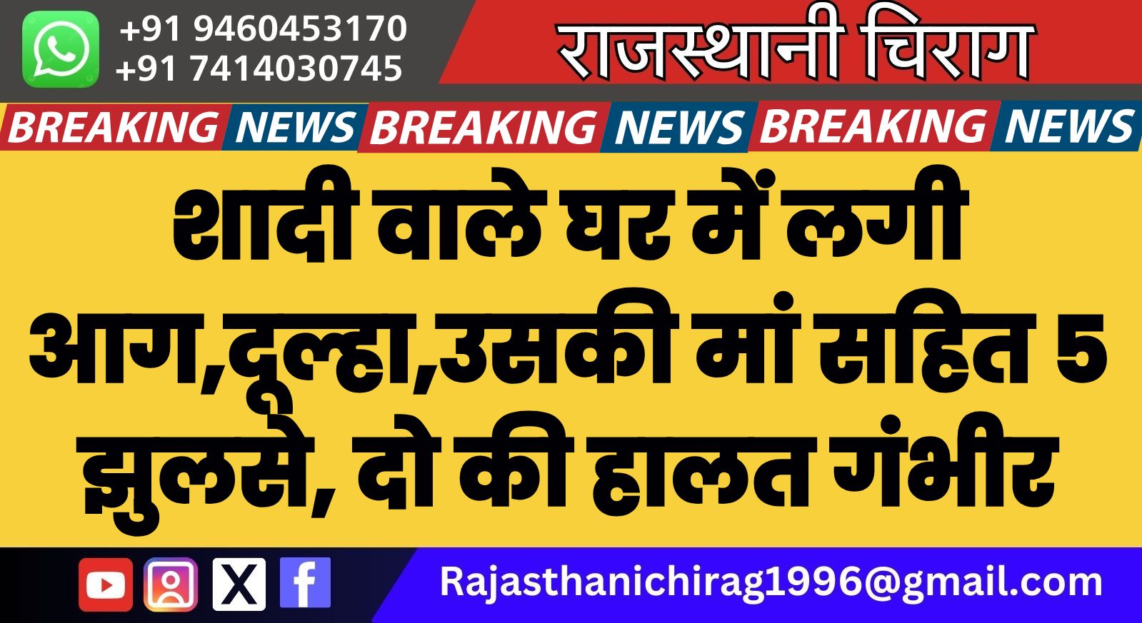 बीकानेर : शादी वाले घर में लगी आग,दूल्हा,उसकी मां सहित 5 झुलसे, दो की हालत गंभीर
